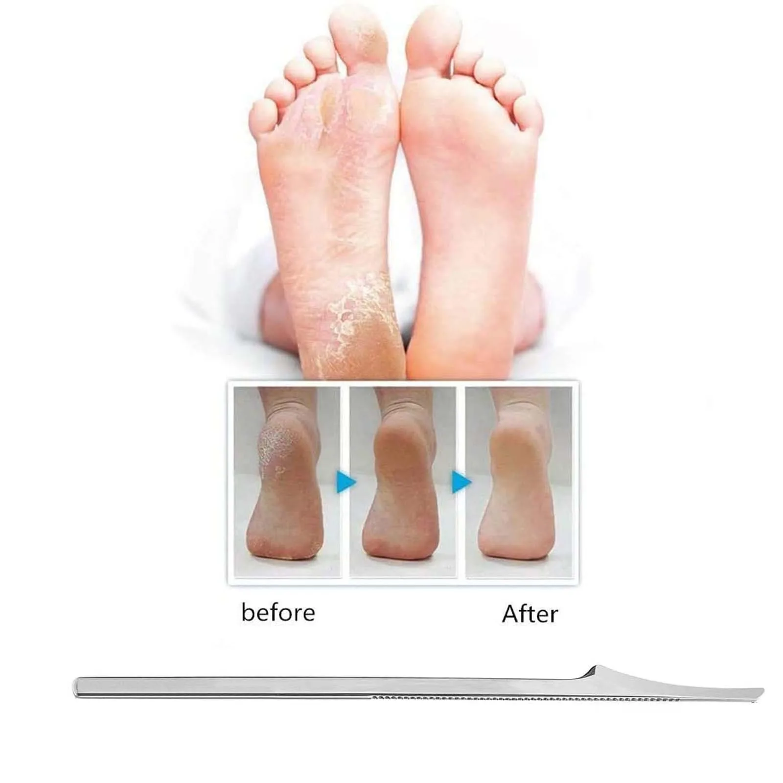 Набор ножей для чистки кожи маленький бытовой набор из металлических приборов