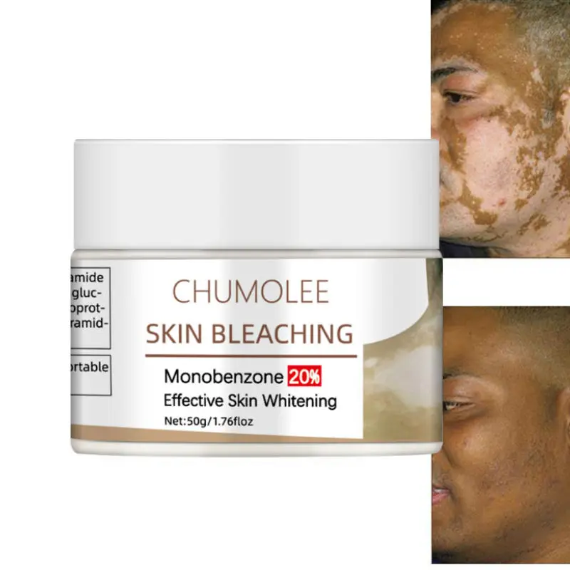 

Монофензонный отбеливающий крем для кожи Chumolee отбеливающий для лица, устранение темных пятен, пигментных пятен, меланин, осветление, уход з...