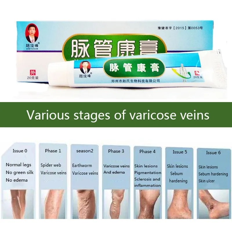 Китайский Пластырь от варикозного расширения вен лечение васкулита мазь для