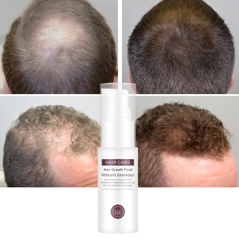

Hair Growth Essence Essential Oil Liquid Spray Nourish Roots Thick Shiny Prevent Hair Loss Anti-Hair for Menwomen Hair Care