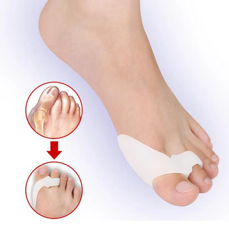 

4Pair Gel Pedicure Tools Silicone Toe Separator Orthopedic Hallux Valgus Guard Correction Straightener Protector Feet Care