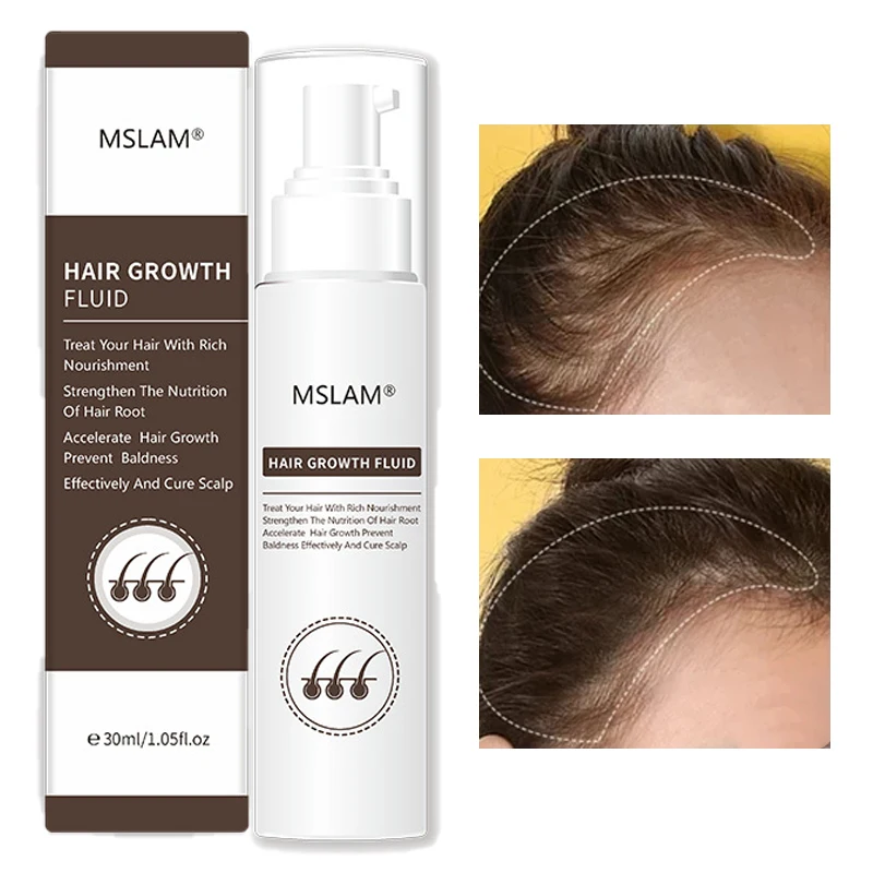 

Hair Growth Fluid Hair Growth Spray Scalp Care Anti-Hair Loss Nourish And Repair Supple Polygonum Multiflorum Hair Care 30ml