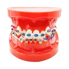 Стоматологическая стандартная Ортодонтическая модель зубов с кронштейнами, букальными трубками и лигатурной проволокой Ортодонтическая обработка