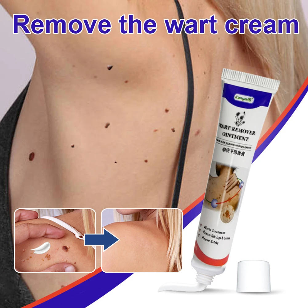 

Skin Tag Remover Cream Painless Wart Removal Ointment Pain Relief for Flat Wart Skin Tag Moles Treatment Cream for All Skins