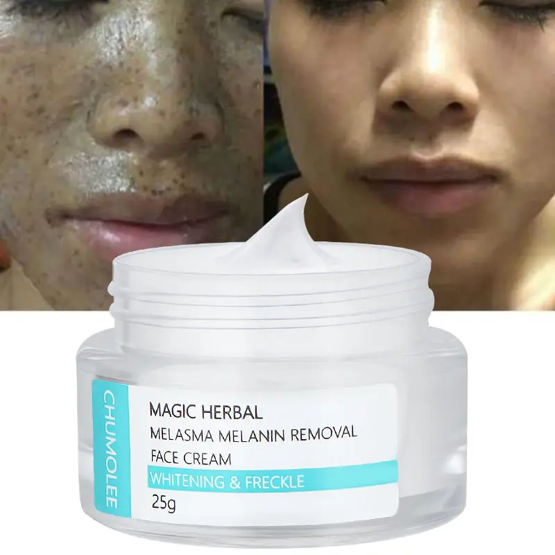 CHUMOLEE мощная бриллиант 25 г быстрое удаление пятен мелазмы пигментных от акне крем