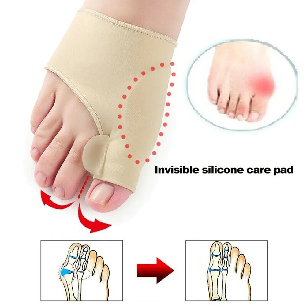 2 пары ортопедические подтяжки для большого пальца стопы|Разделители пальцев