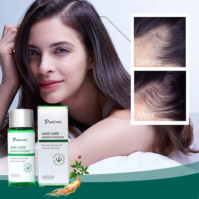 Эссенция PUTIMI против выпадения волос для мужчин и женщин 20 мл эфирное масло роста