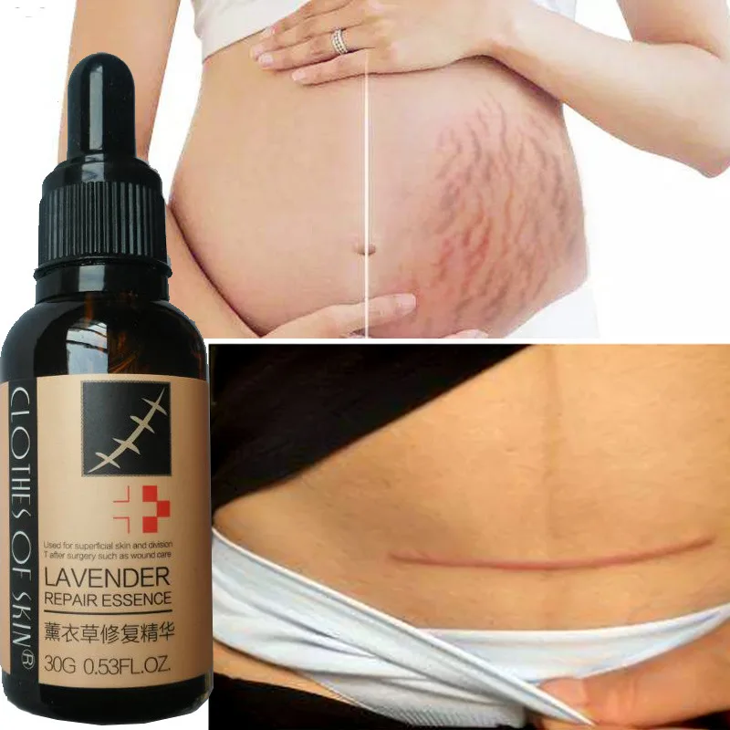 2 шт. экстракт лаванды стрейч Знаки/шрам восстанавливающая эссенция Знаки/Крем