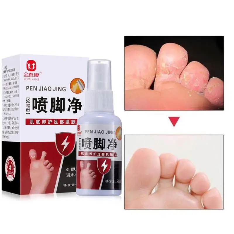 50ml Fungal Infections Foot Spray Feet Care Athlete's Odor Sweat Itching Peeling Beriber Itinea Pedis |