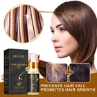 Эфирное масло для роста волос предотвращает выпадение волос, восстанавливает поврежденные волосы, густые волосы, масло для роста волос, уход за волосами для женщин и мужчин