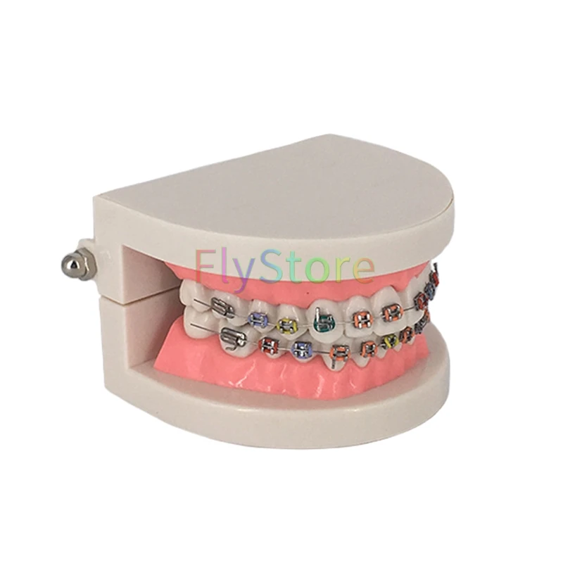 

1pc Dental Orthodontic Tooth Model TreatmentWith Ortho Metal Ceramic Bracket Arch Wire Buccal Tube Ligature Ties