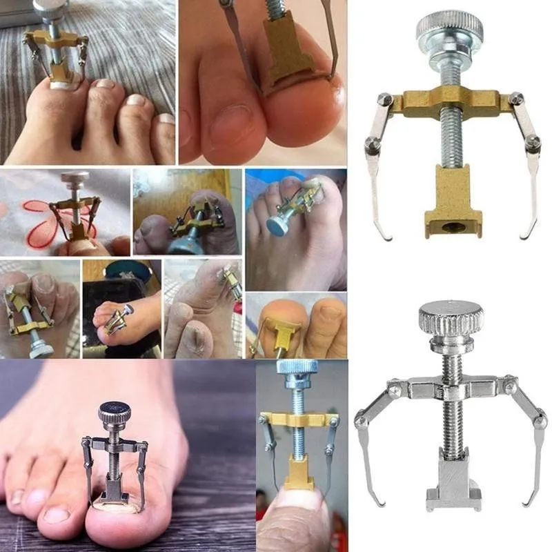Nail Art Инструмент Коррекции Одометра Сталь пальцов ноги и ногти мясо педикюр