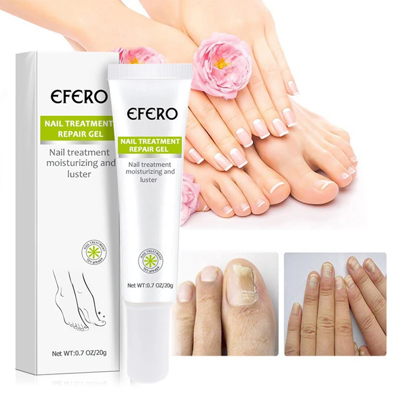

Fungal Nail Treatment Serum Nail Foot Nail Fungus Removal Gel Anti Infection Onychomycosis Nail Repair Essence Cream Feet Care