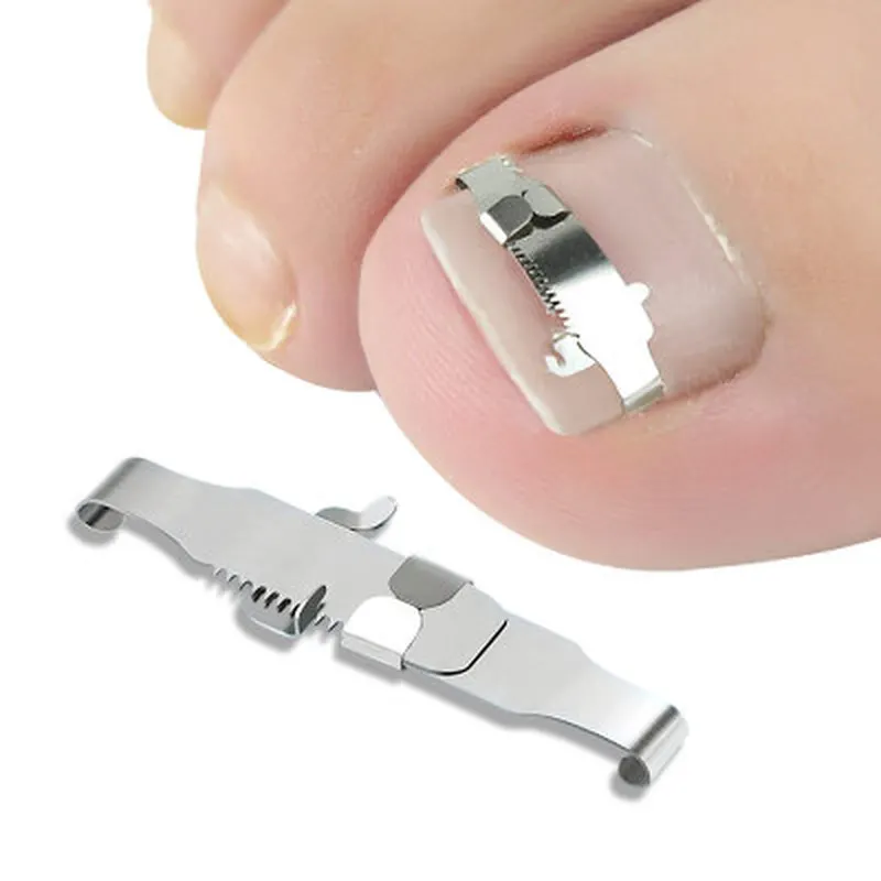 

Ingrown Toenail Corrector Orthotic Nail Fixer Toenail Correction Treatment Foot Care Tools Recover Embed Tool Corrector Pedicure