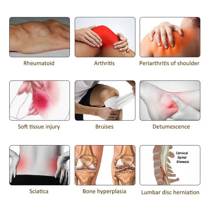 Спрей для снятия боли при ревматизме и артрите ортопедический спрей в колене