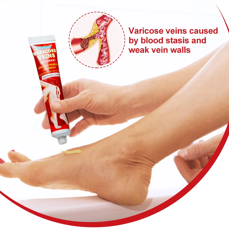 

Body Cream Varicose Vein Cream Skin External Ointment Treatment Skin Men and Women Body Care