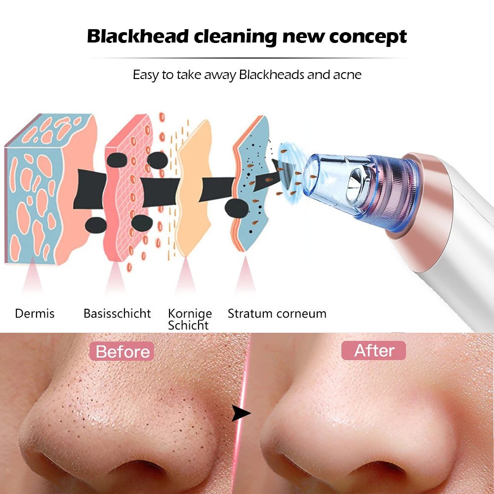 

Blackhead Remover Face Deep Nose Cleaner T Zone Pore Acne Pimple Removal Vacuum Suction Facial Diamond Beauty Clean Skin Tool
