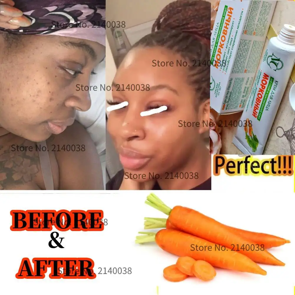 Чистый золотой морковь с арбутином яркий и бледный крем для темной кожи