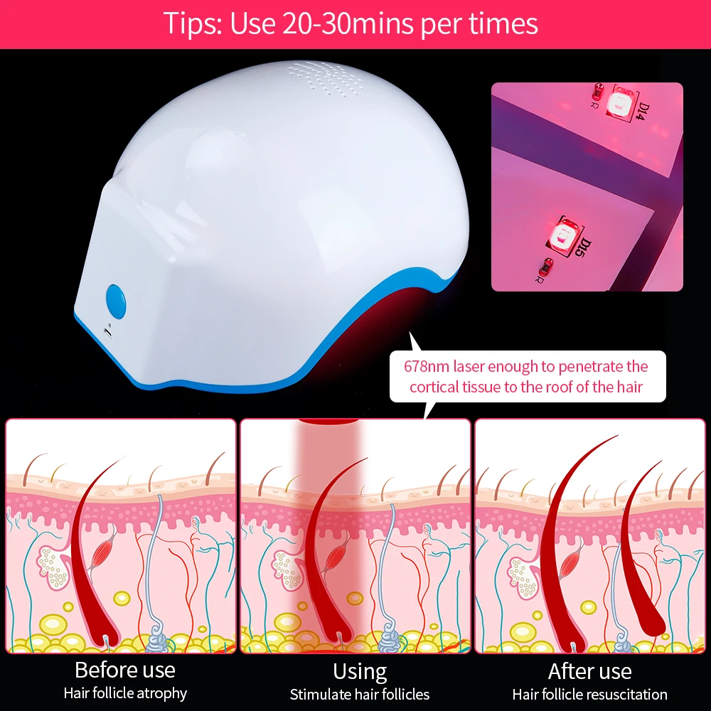 Лазерный шлем для восстановления волос с защитой от выпадения защита роста