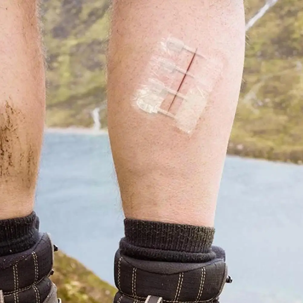 

1pc молнией не вызывает болезненных ощущений закрытия раны устройства без игл Шовный-Бесплатная швом и застежкой-молнией патч для установки ...