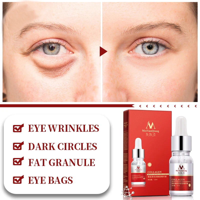 

Skin care essence Anti-aging eye skin care essence 2Pcs deep facial firming essence