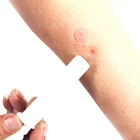 Безопасная аптечка безопасная защита от яда змеи пчелы укуса кемпинга выживания выделитель ядов комплект 1 шт