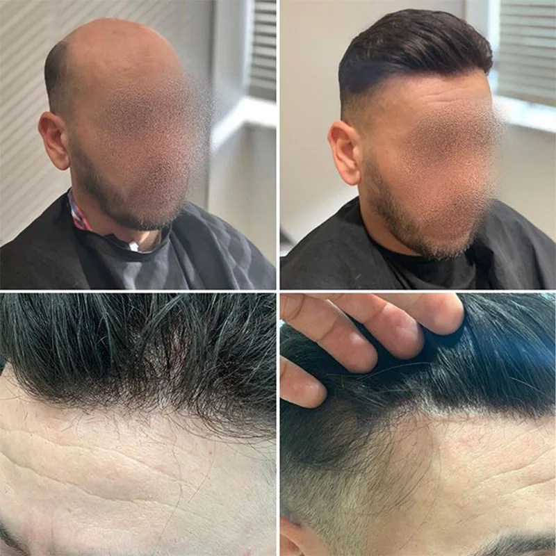 Французская кружевная Передняя Мужская s Toupee Poly вокруг париков человеческие