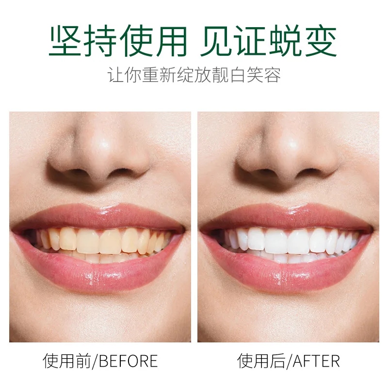 Зубная паста для здорового отбеливания зубов окрашенная желтая зубная Большая