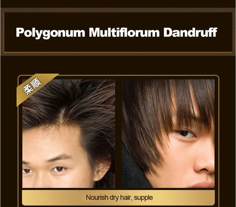 200 мл шампунь Multiflorum Китайский травяной удаление перхоти против выпадения волос