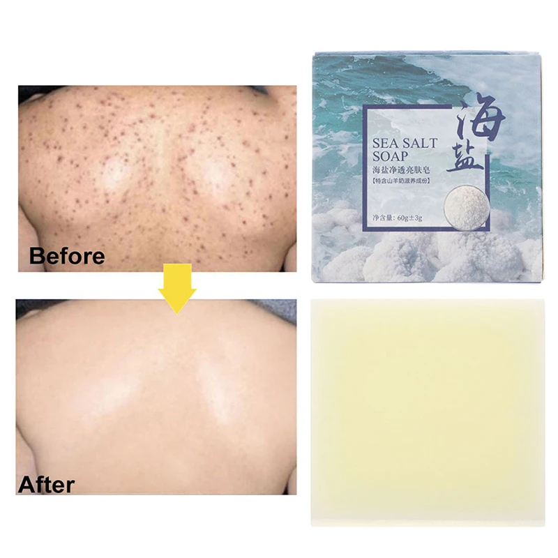 Китайское мыло sea salt soap. Соляное мыло. Китайское мыло. Антимикробное мыло для лица. Мыло соль лицо.