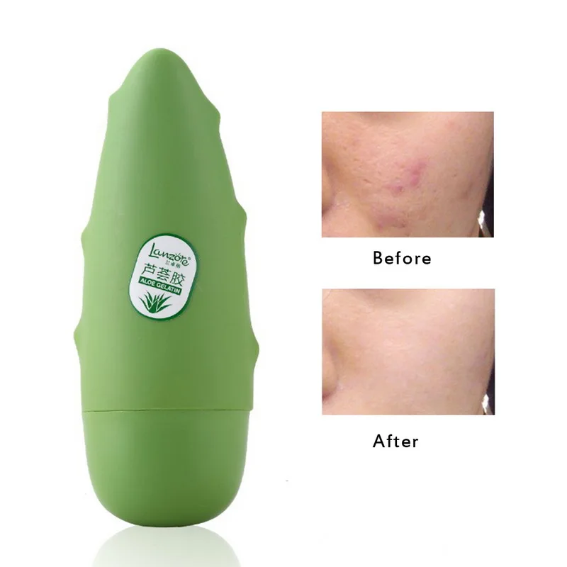 Увлажняющий отбеливающий крем для лица с алоэ вера против акне одноразовая маска