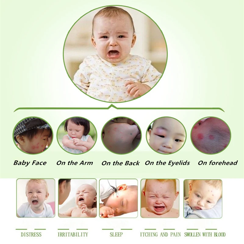 

Anti-Itching Cream Relief Cooling Refresh Chinese Herbal Medical baby cool refreshing anti-mosquito Anti-itching Cream
