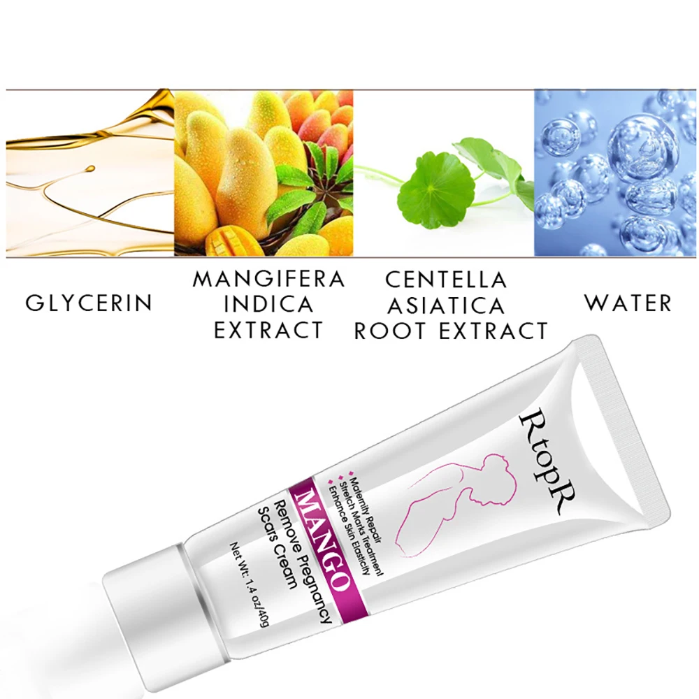 Treatment Stretch Mark Cream Fade Obesity Lines Promote Cell Regeneration Enhance Skin Elasticity Pregnant Women Postpartum Care | Красота и