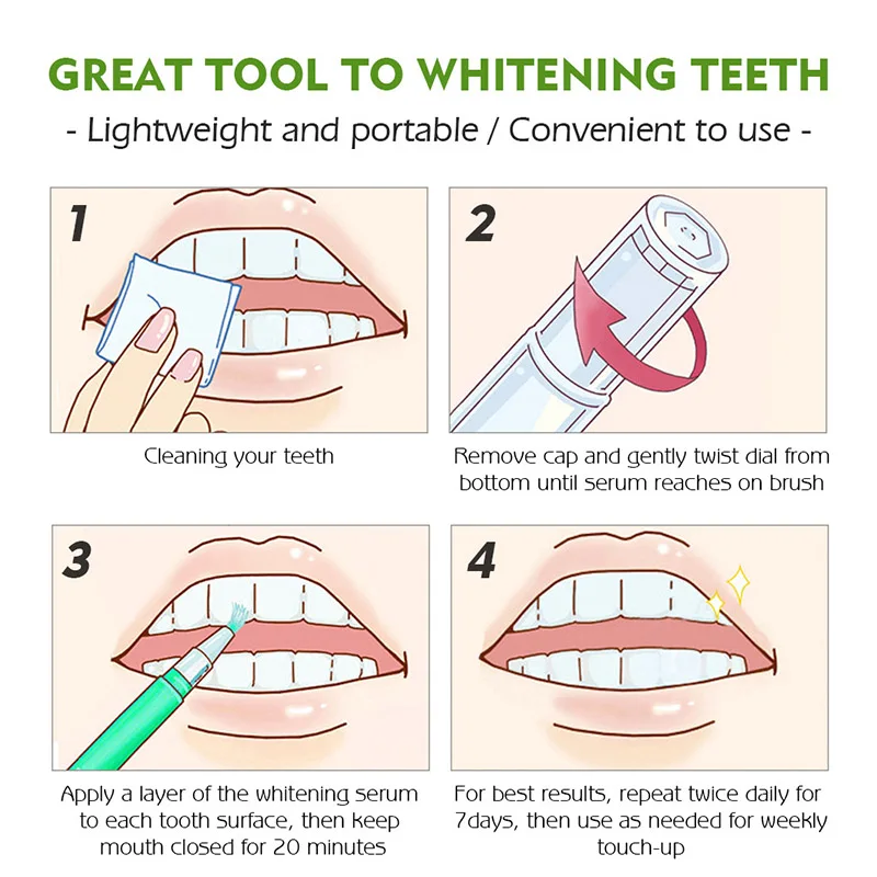 

Teeth Whitening Pen Effective Painless No Sensitivity Beautiful White Smile MH88