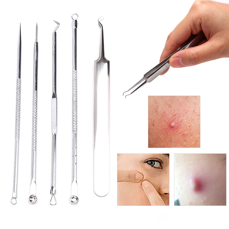 5pcs Blackhead Pimple Spot Comedone Acne Needle Extractor Remover Popper Tool Kit With Box