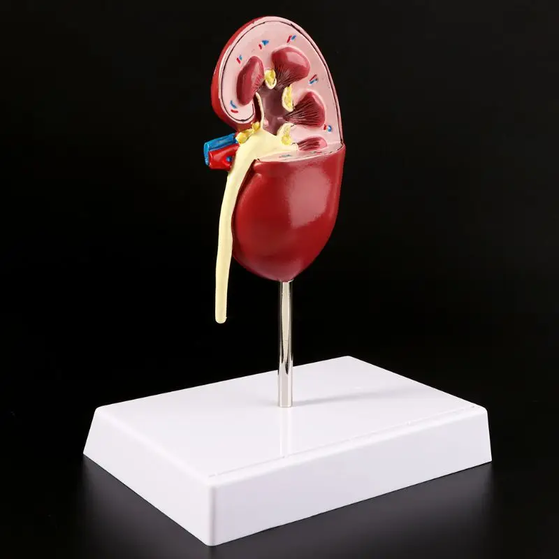 

2021 New Life Size Human Kidney Diseased Model Anatomical Anatomy Diseased Pathological Stone Organ Teaching Supplies