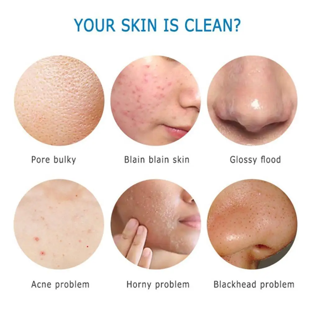 

Natural Oil Soap Organic Herbal Essential Whitening Remove Face Acne Soap Deep Care Handmade Skin Cleaning Hair D2A4