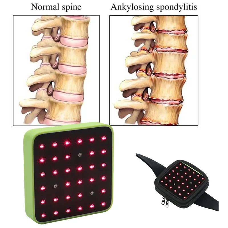 Инструмент физической терапии для облегчения боли в суставах улучшения