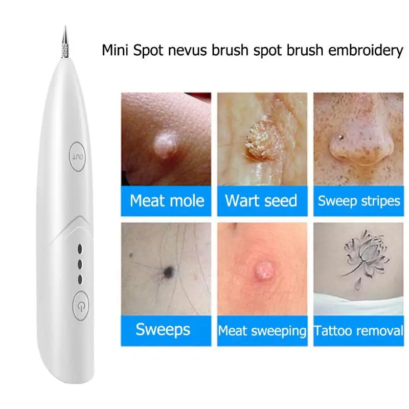 Лазерная ручка для удаления крота красота уход за кожей лица Кукуруза Веснушка