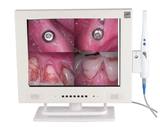 

Denspay new model dental intraoral camera with15 inch lcd monitor
