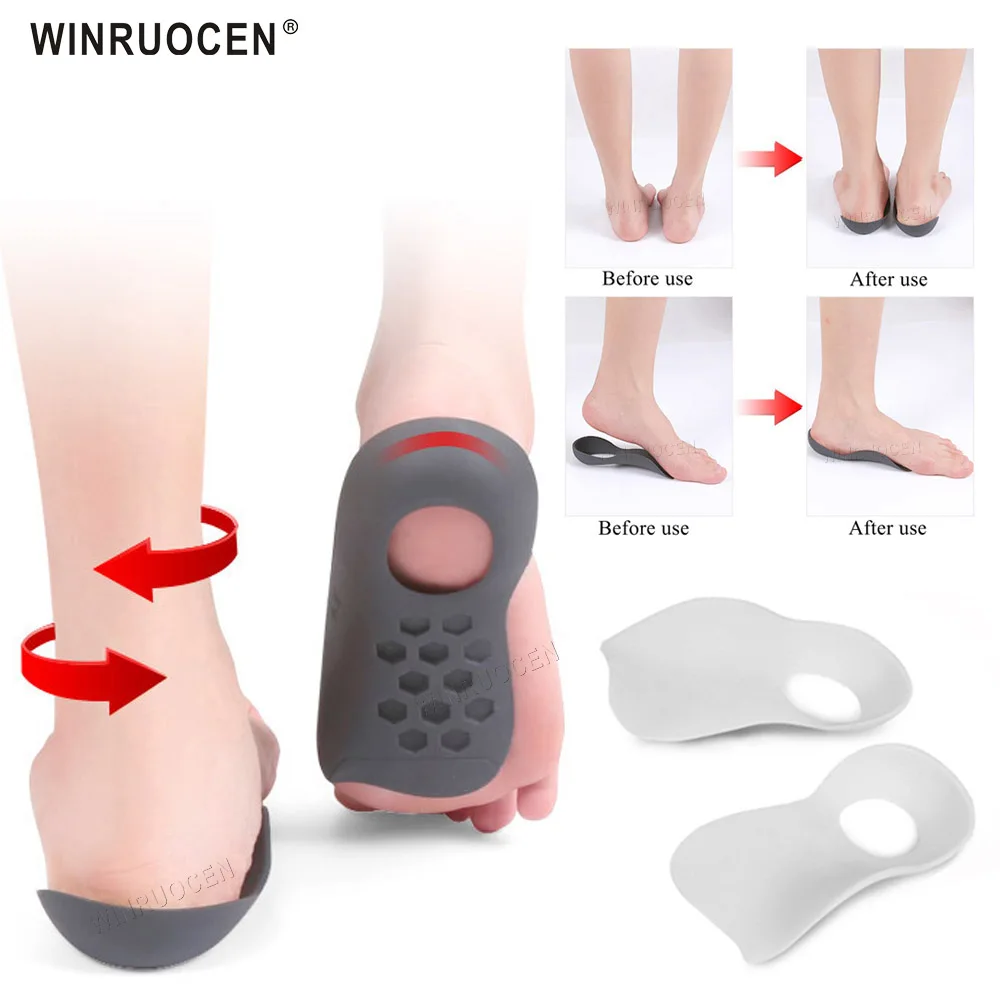 

1 Pair Orthopedic Orthotic Insole Arch Support Insole Flatfoot O-Type Leg Foot Valgus Correction Shoe Insert Non Slip