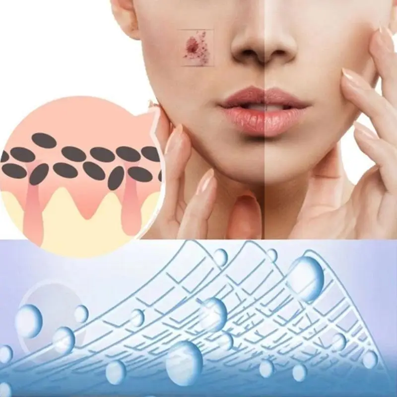 

30g Ginger Exfoliating Hyaluronic Acid Nourishing Moisturizing Gel Lotion N4R8