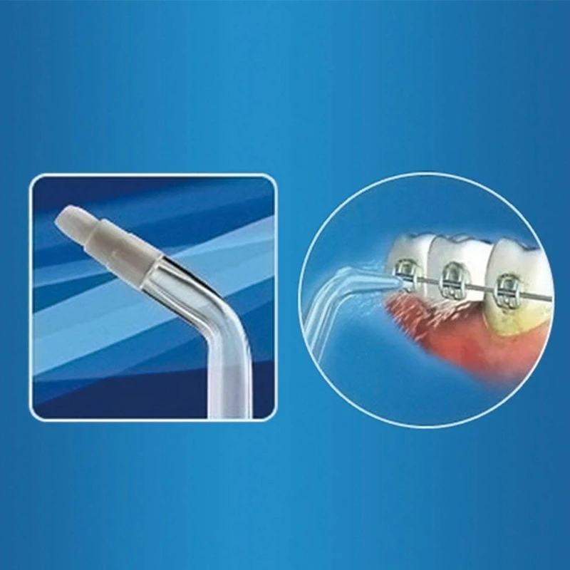 

1PCS Replacement Orthodontic Tips for Waterpik Water Flossers Random Color