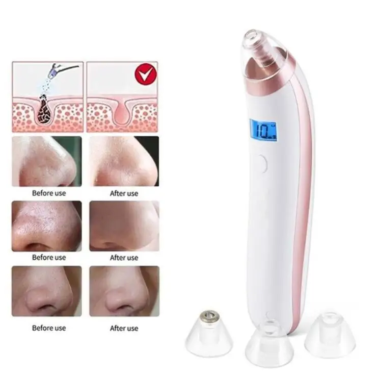 Электрический инструмент для удаления угрей Noir черных точек очиститель пор уход