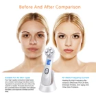 5 в 1 мезотерапия Электропорация RF Радиочастотное косметическое устройство для лица антивозрастной подтяжки лица подтягивание Омоложение Уход