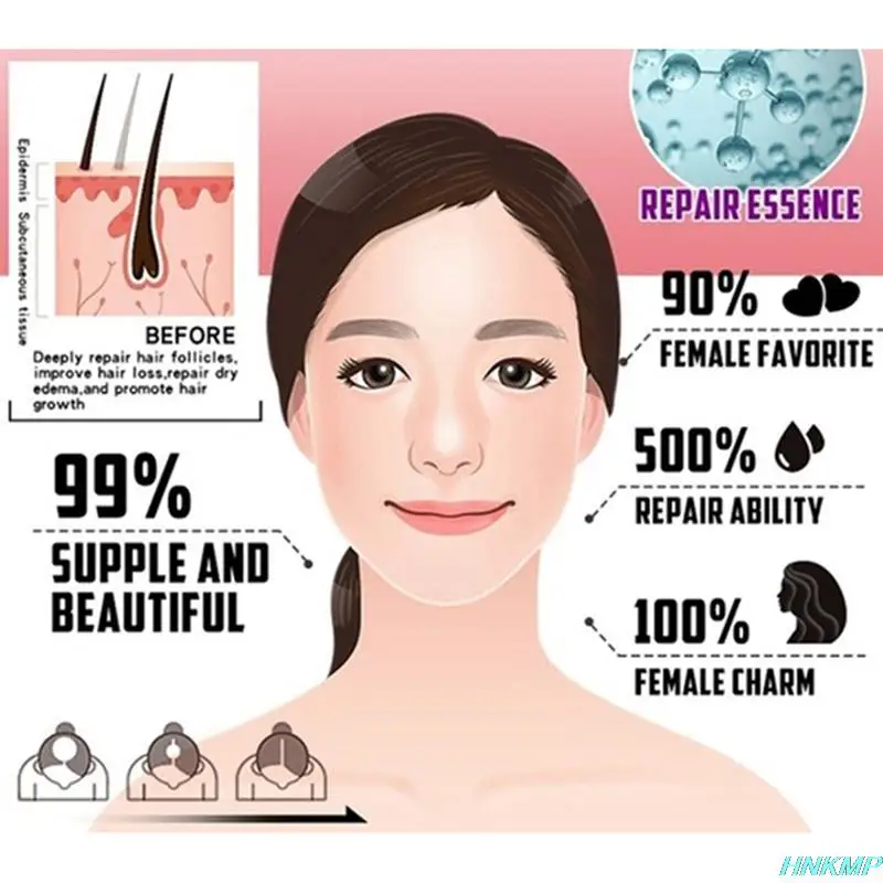 Новинка 2021 сыворотка для быстрого роста волос 20 мл жидкость предотвращения