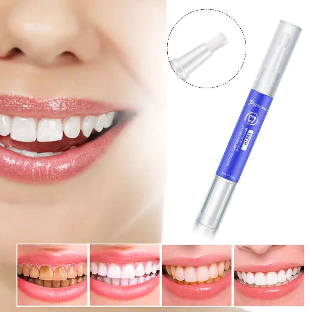 5 мл средство для мгновенного удаления пятен отбеливания полости рта портативная