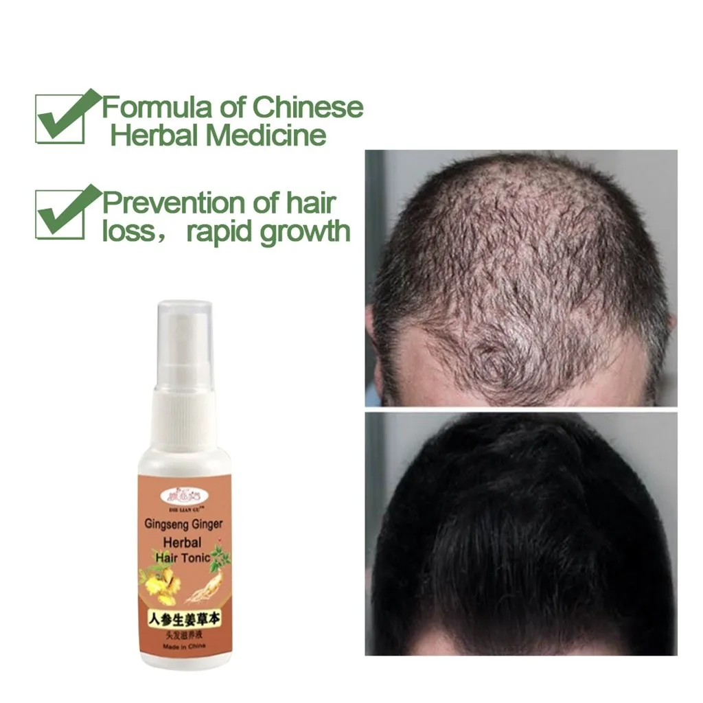 Горячий женьшень имбирь спрей для роста волос быстро расти выпадение волокна