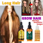 Натуральный имбирь для быстрого восстановления волос, жидкость для лечения выпадения волос, жидкая биотин для роста волос, 302010 мл