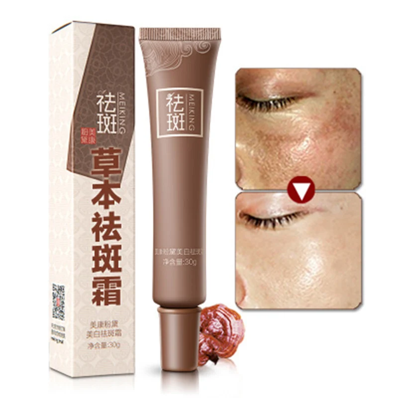 

Reduces Freckles Cream Fade Dark Spot Facial Whitening Lightening Gel Skin Care Cream @ME88